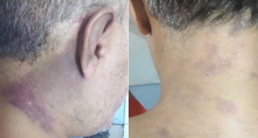 Brutal ataque a un comerciante: intentaron ahorcarlo y le rompieron el tendón de Aquiles