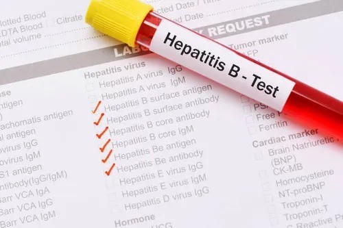 Hepatitis A: confirman 32 nuevos casos y Argentina entra en alerta sanitaria