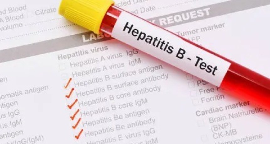 Hepatitis A: confirman 32 nuevos casos y Argentina entra en alerta sanitaria