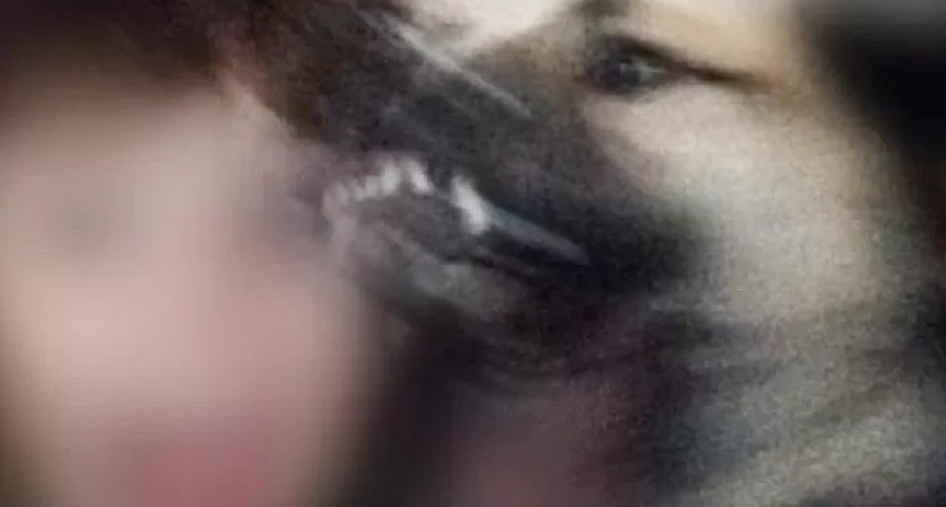 UN NIÑO FUE ATACADO POR UN PERRO PITBULL EN CERCANIAS DE EL EX COLEGIO NACIONAL